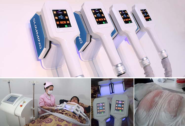 coolsculpting machine