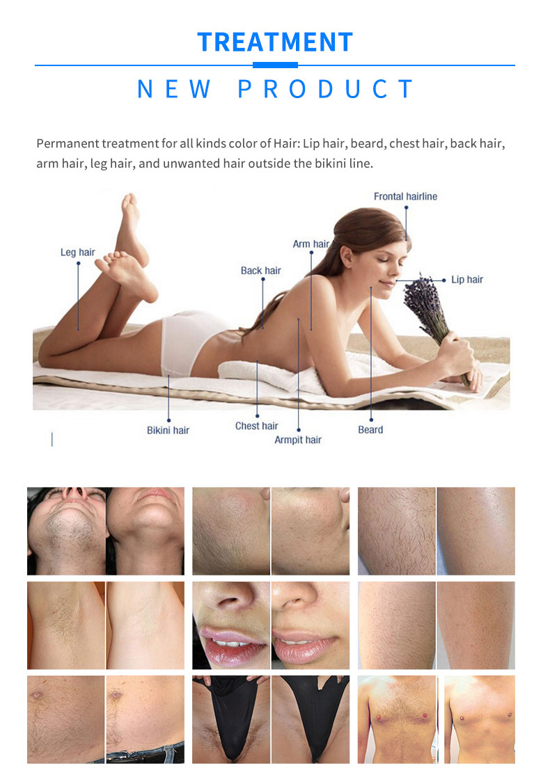 laser hair removal machine.jpg laser hair removal machine.jpg