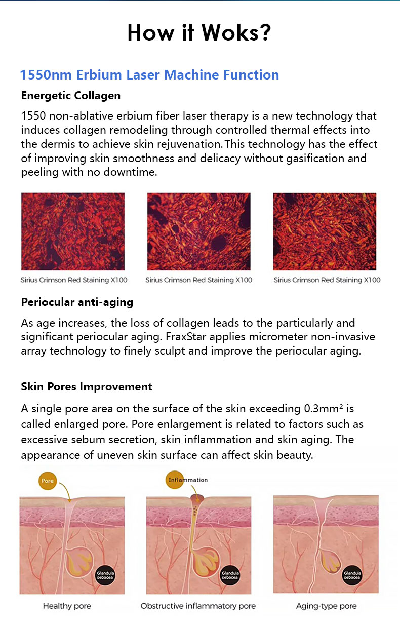 Skin Rejuvenation Machine.jpg Skin Rejuvenation Machine.jpg