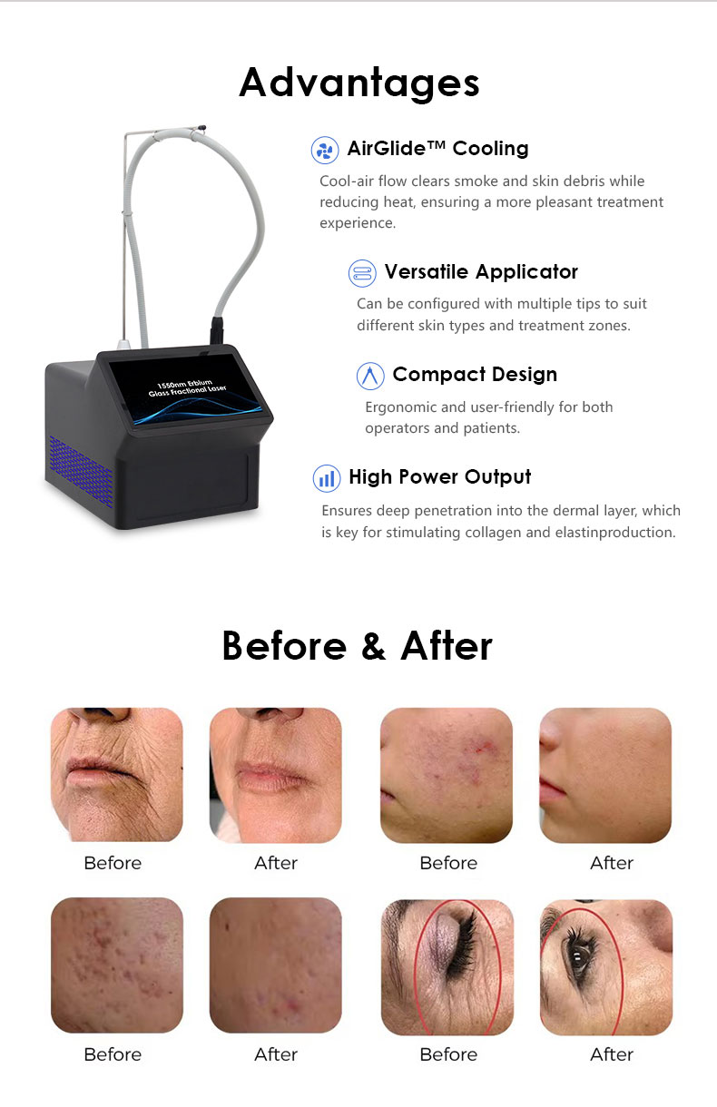 Skin Rejuvenation Machine.jpg Skin Rejuvenation Machine.jpg