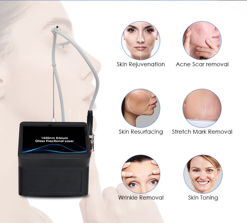 Skin Rejuvenation Machine.jpg Skin Rejuvenation Machine.jpg