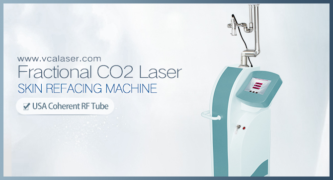 How Much Does CO2 Laser Cost?