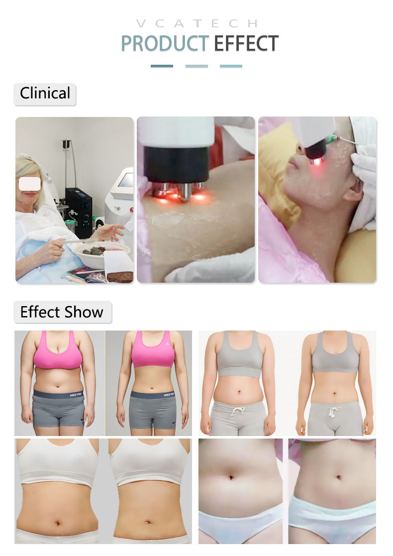 Cavitation Vacuum RF Laser Slimming.jpg