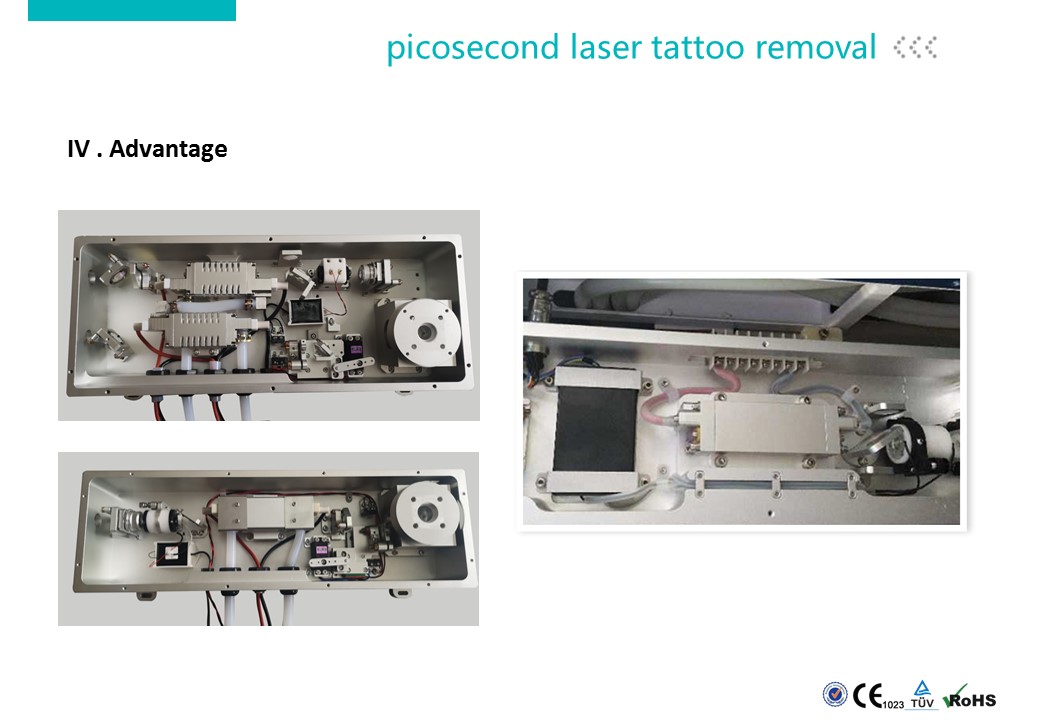 picosecond laser tattoo removal.JPG