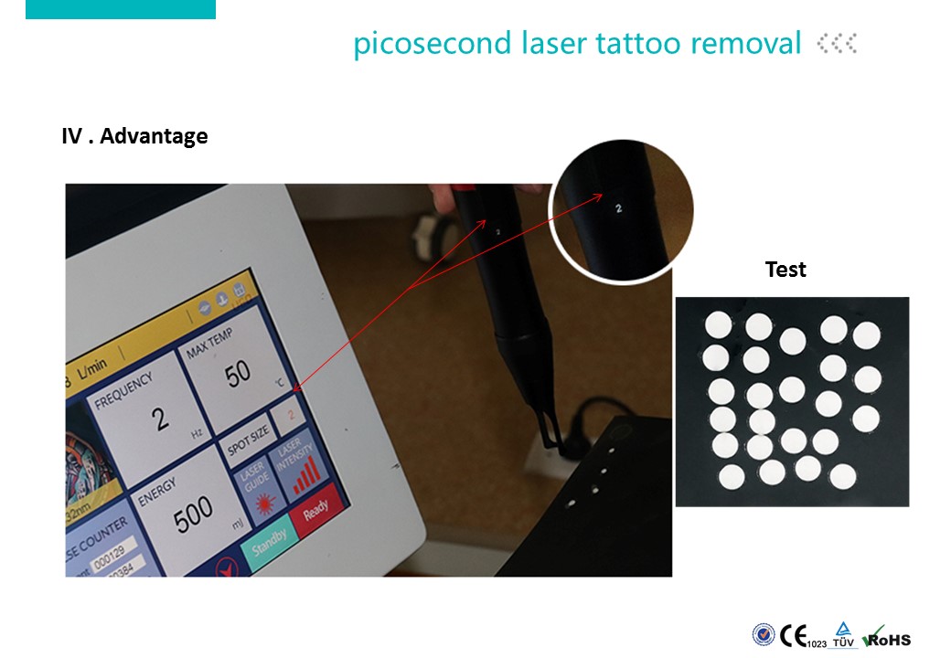 laser tattoo removal.JPG