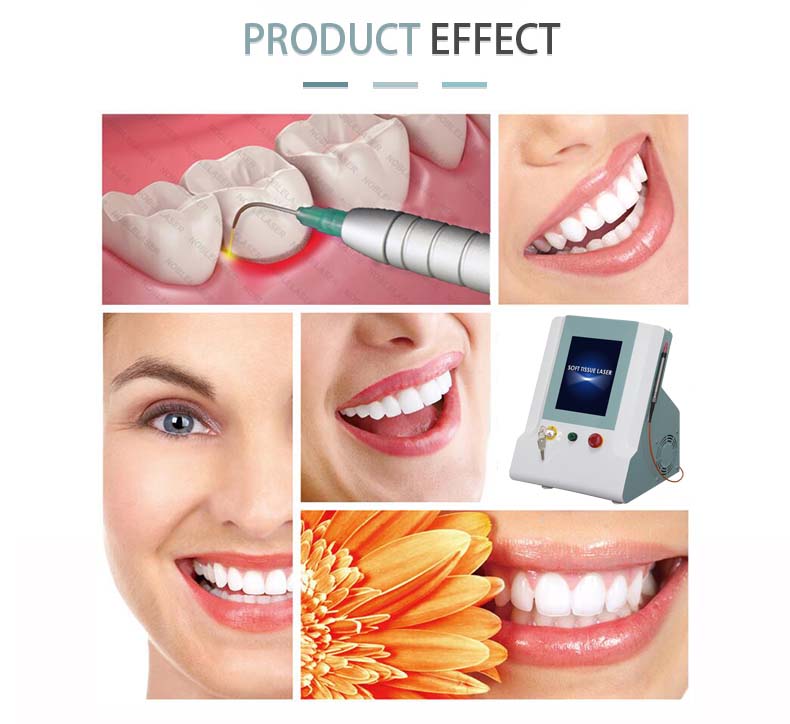 Teeth Whitening machine.jpg