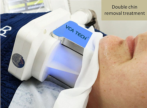 Double chin removal handle for Cryolipolysis fat freezing slimming machine