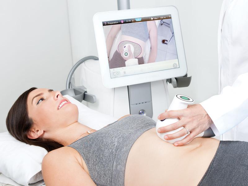 UltraShape: faster, virtually painless and with no downtime