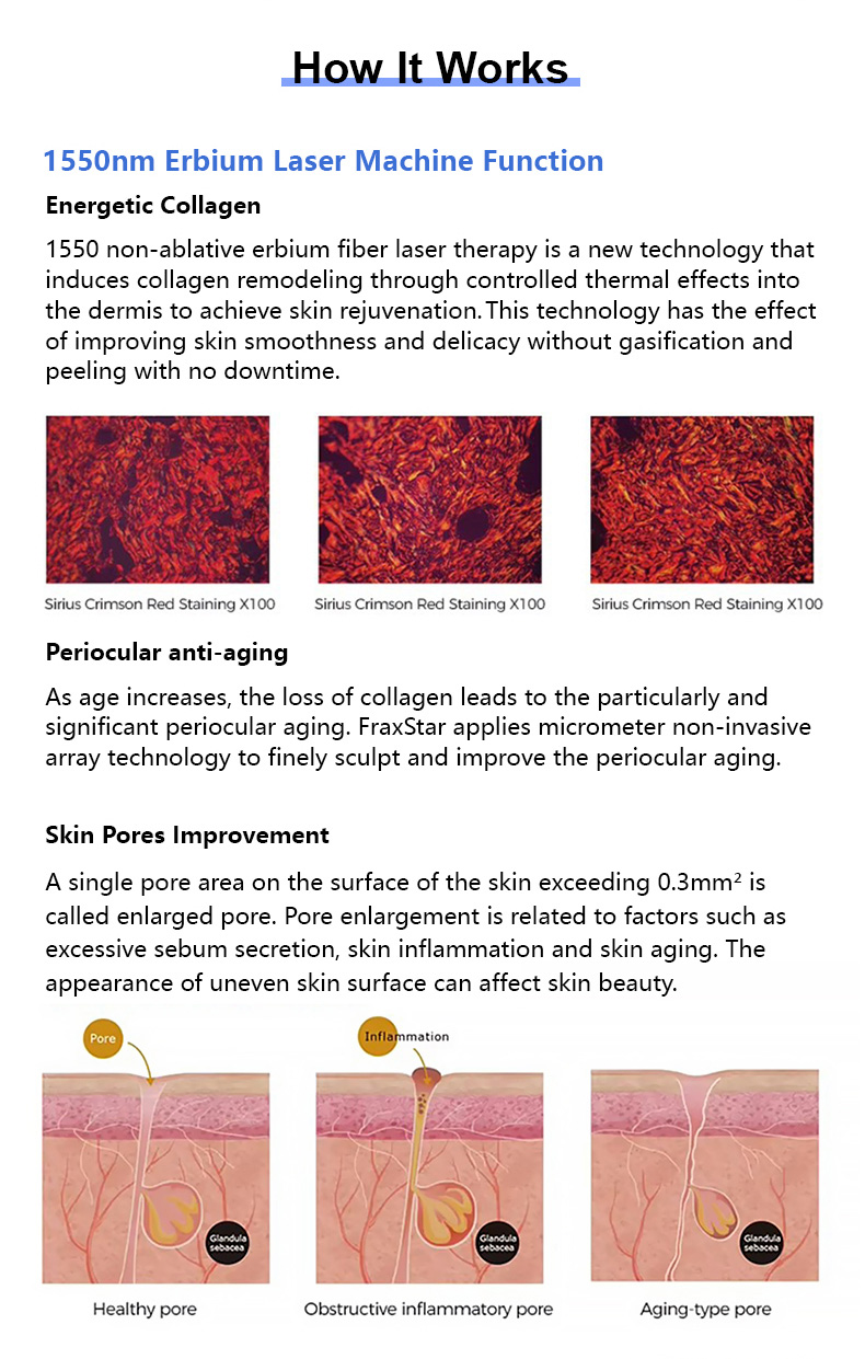 Skin Resurfacing 