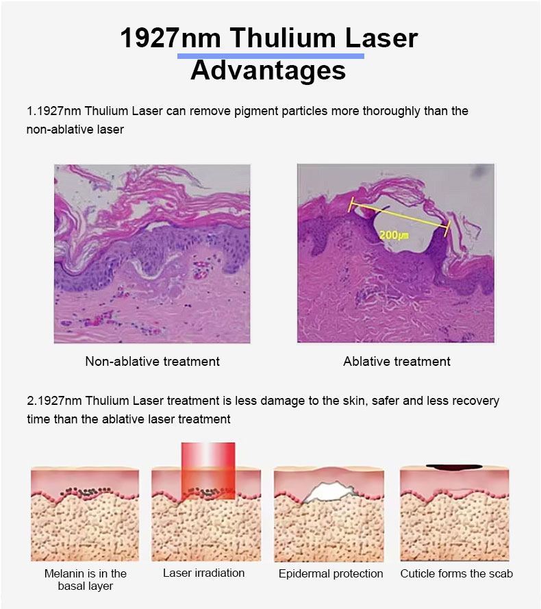 Skin Resurfacing.jpg