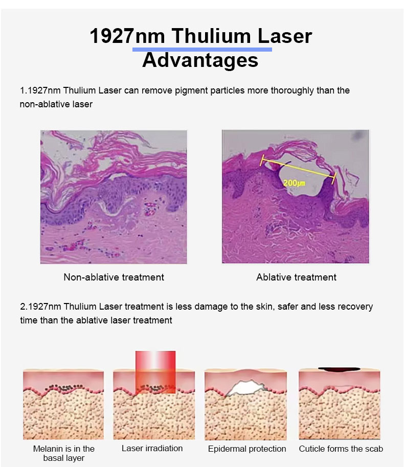 Skin Resurfacing.jpg