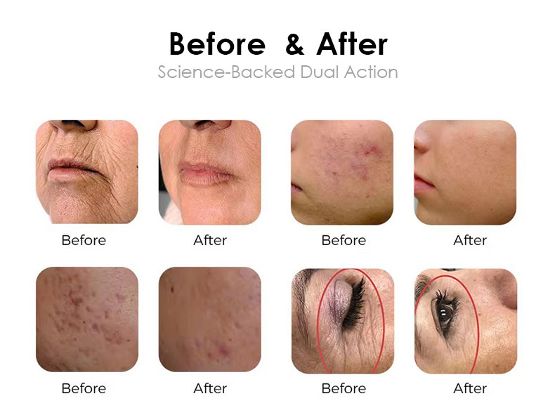 Skin Resurfacing.jpg