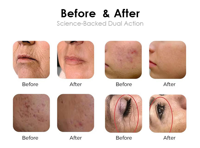 Skin Tightening.jpg