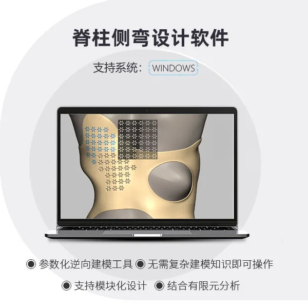 脊柱侧弯支具设计软件