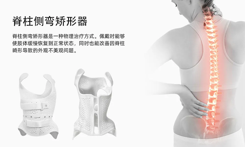 贝生领行（BASINGLEAD）——脊柱侧弯3D数字化矫形整体解决方案