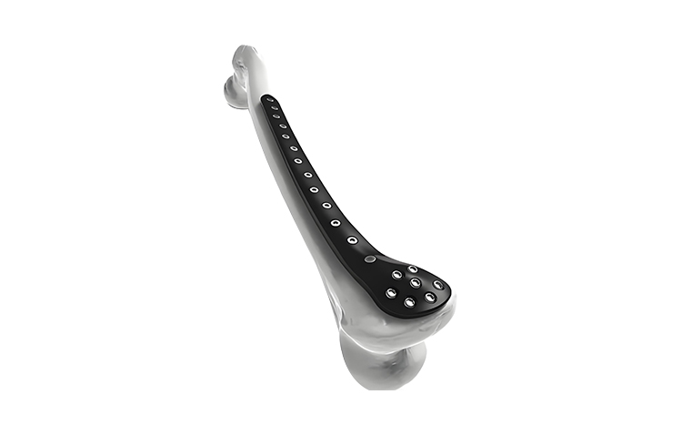 Carbon fiber medical stent