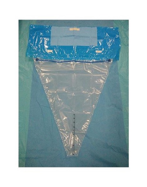 Sterile Underbuttocks Surgical Drape with Pouch