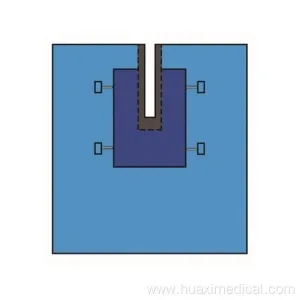 Medical Disposable Surgical Drape U-Split U Shape Drape